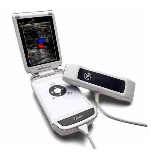 ECHOGRAPHE GE VSCAN – Image 3