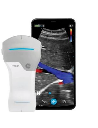 ECHOGRAPHE GE VSCAN – Image 5