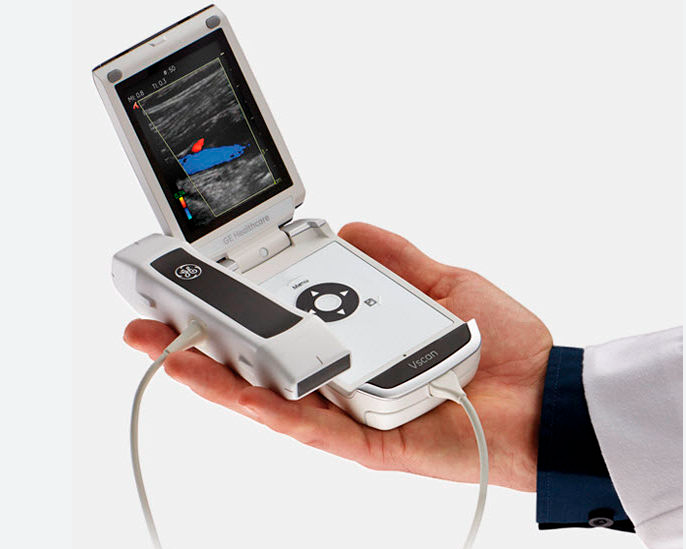 ECHOGRAPHE GE VSCAN – Image 4