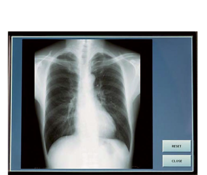 APPAREIL DE RADIOGRAPHIE MOBILE MOTORISEE 32 KW – Image 5