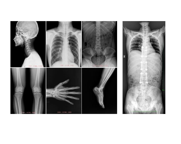 APPAREIL DE RADIOGRAPHIE TELECOMMANDEE – Image 5