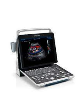 ECHOGRAPHE DOPPLER COULEUR U50 + 1 SONDE – Image 4