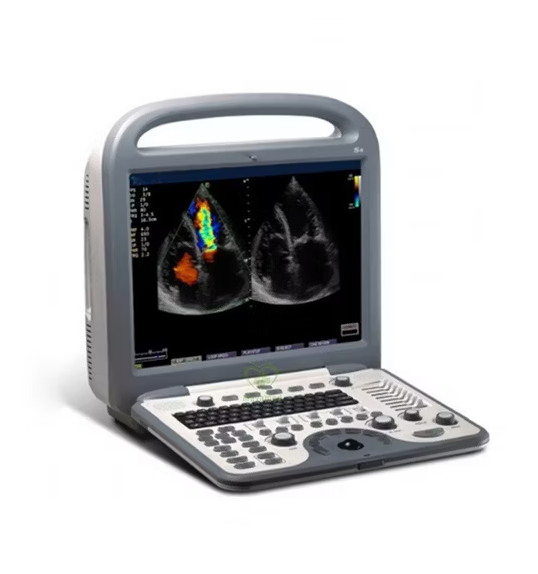 ECHOGRAPHE DOPPLER COULEUR U50 + 1 SONDE – Image 2