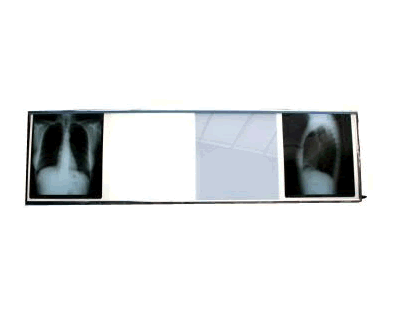 NEGATOSCOPE 4 PLAGES – Image 4