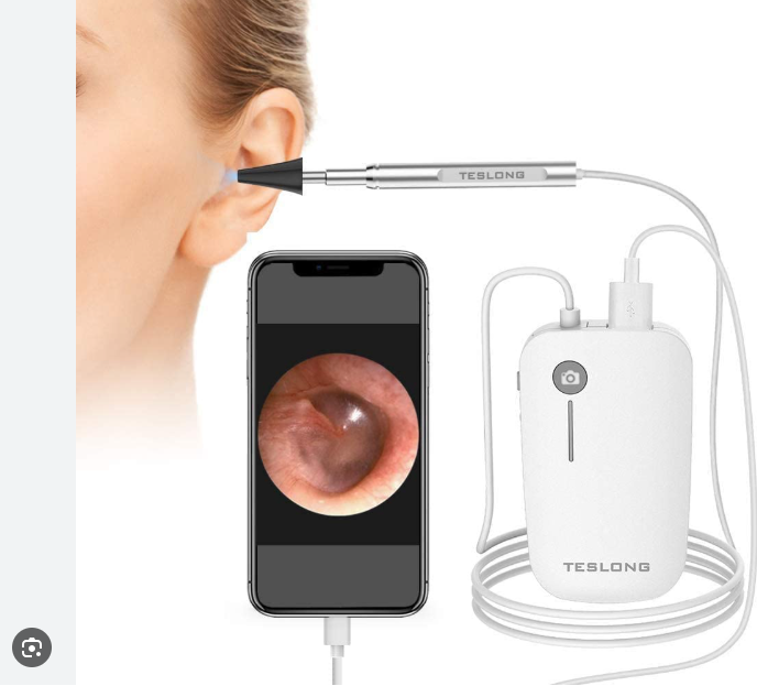 OTOSCOPE CAMERA LED LUMIERE POUR IPHONE ET ANDROID – Image 3