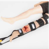 ATTELE TRACTION SPLINT – Image 7