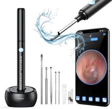 OTOSCOPE OREILLE AVEC CAMERA - NETTOYEUR D'OREILLE – Image 3