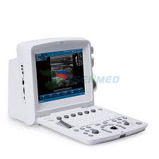 ECHOGRAPHE PORTABLE DOPPLER COULEUR EDAN U50 – Image 2