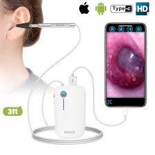 OTOSCOPE OREILLE AVEC CAMERA - NETTOYEUR D'OREILLE – Image 6