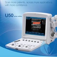 ECHOGRAPHE PORTABLE DOPPLER COULEUR EDAN U50 – Image 3