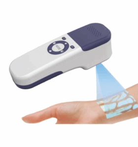 DETECTEUR DE VEINES