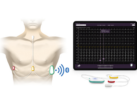 ECG CARDIOSECUR – Image 5