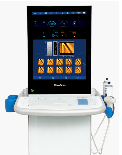 FIBROSCAN – Image 5