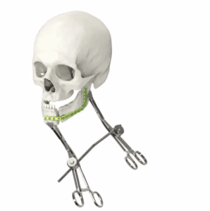 PINCE DE PREHENSION ORTHOPEDIQUE