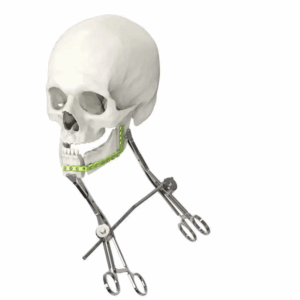 PINCE DE PREHENSION ORTHOPEDIQUE