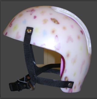 CASQUE ORTHESE ORTHOPEDIQUE DE REMODELAGE CRANIEN – Image 6