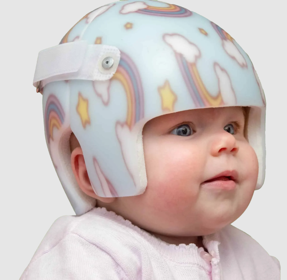 CASQUE ORTHESE ORTHOPEDIQUE DE REMODELAGE CRANIEN – Image 2