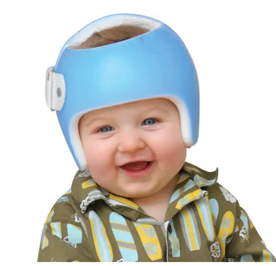 CASQUE ORTHESE ORTHOPEDIQUE DE REMODELAGE CRANIEN