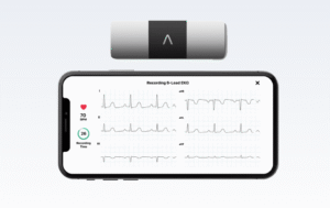 ECG PORTABLE KARDIAMOBILE 6L