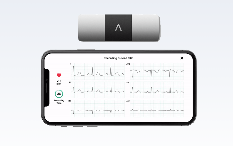 ECG PORTABLE KARDIAMOBILE 6L